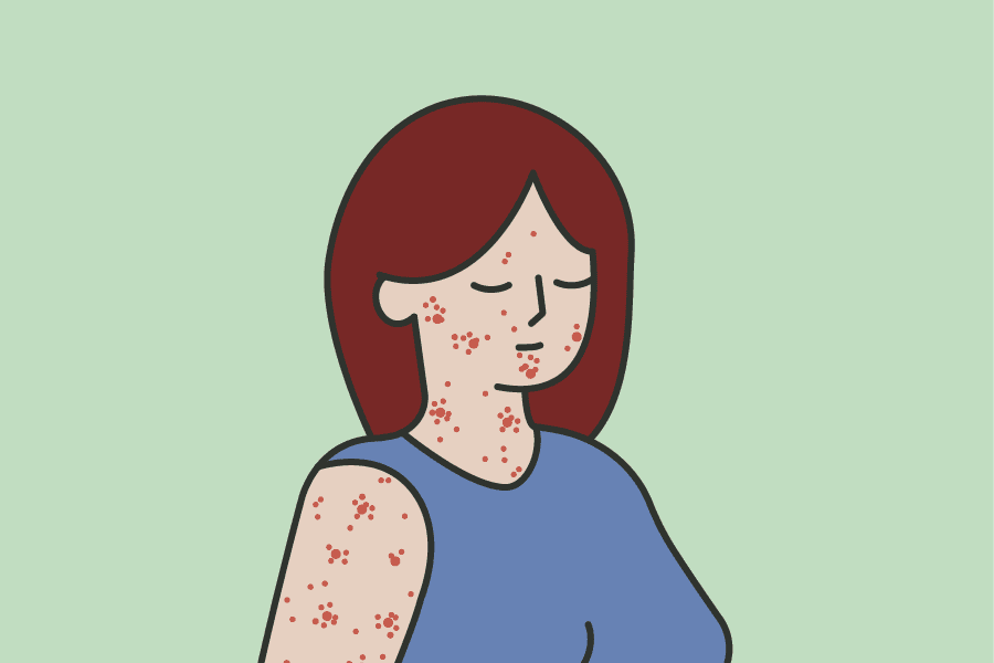 d_roda hud rubella